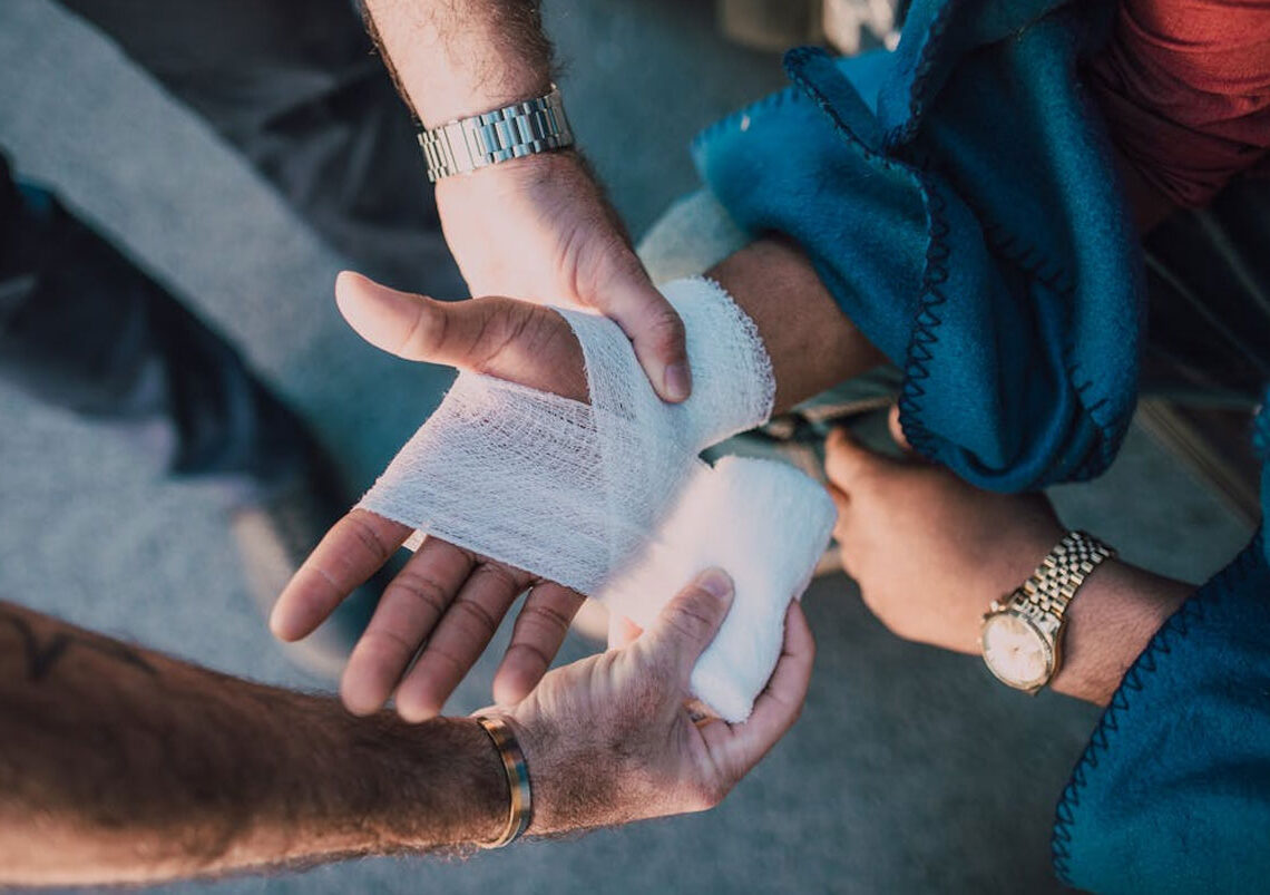 Burns Injury Compensation