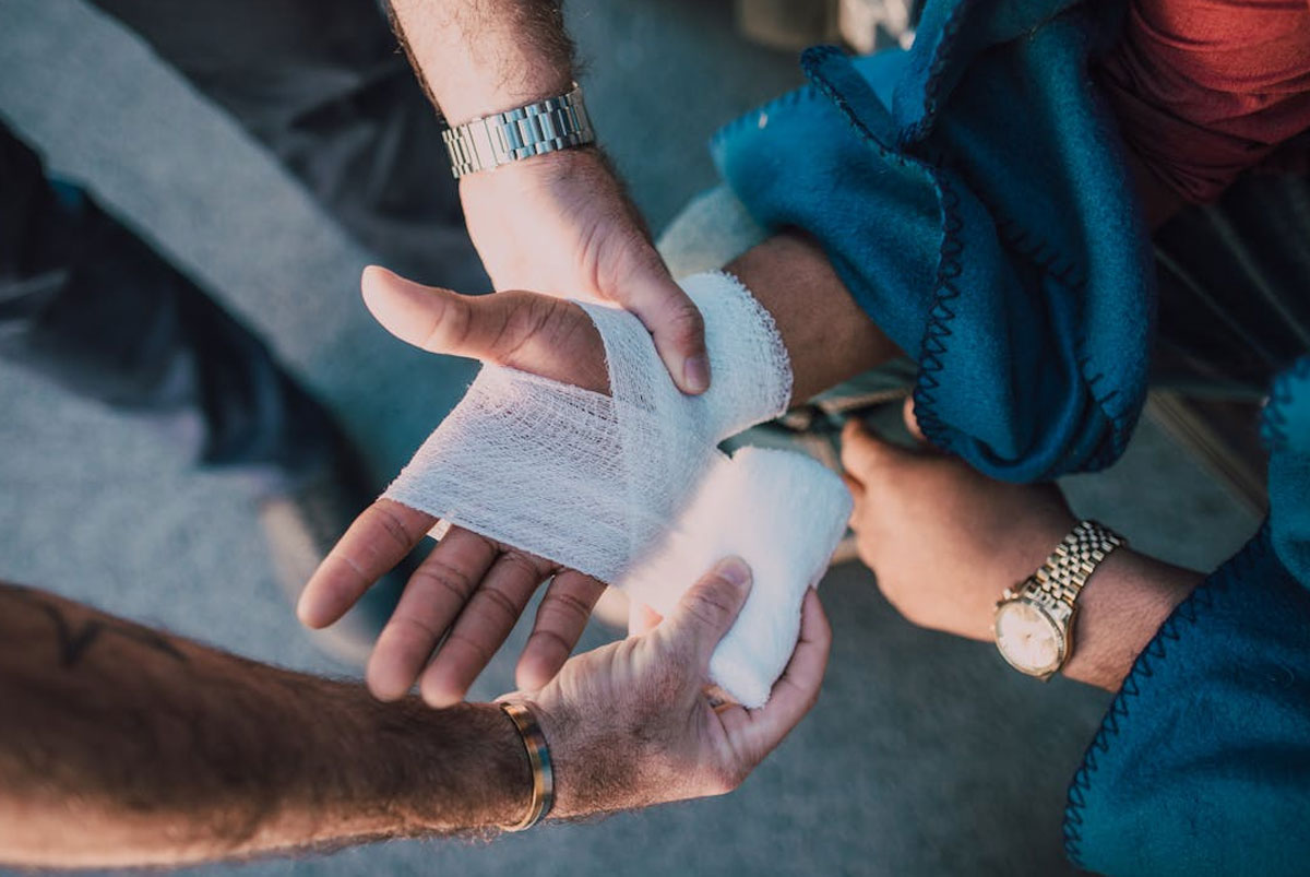 Burns Injury Compensation