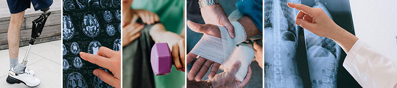 serious injury claims