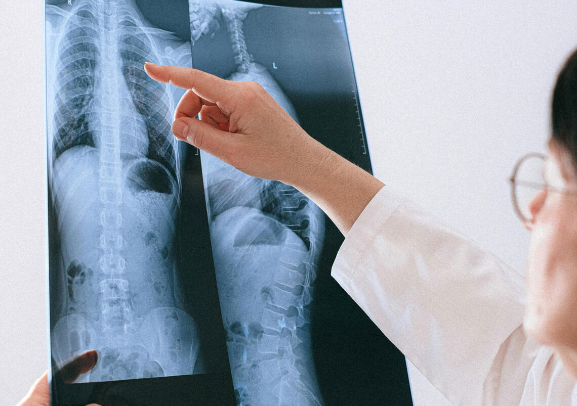 spinal injury compensation